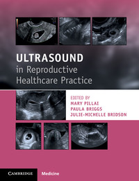 Cover image: Ultrasound in Reproductive Healthcare Practice 9781316609736