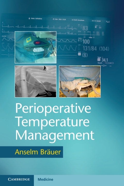 Cover image for book Perioperative Temperature Management