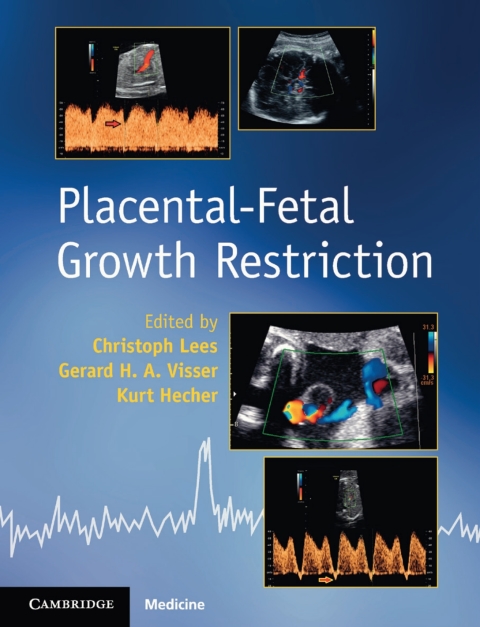 Cover image for book Placental-Fetal Growth Restriction