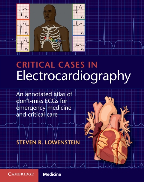 Cover image for book Critical Cases in Electrocardiography