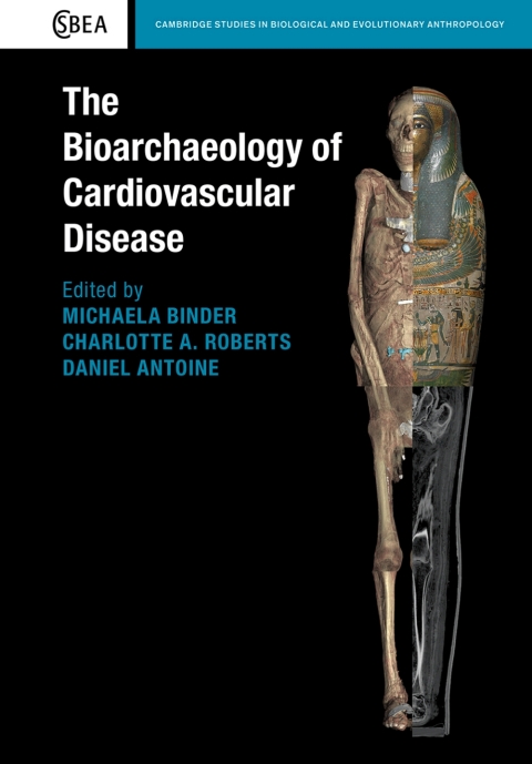 Cover image for book The Bioarchaeology of Cardiovascular Disease
