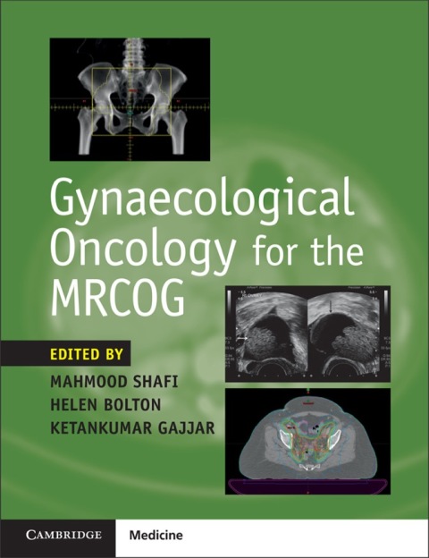 Cover image for book Gynaecological Oncology for the MRCOG