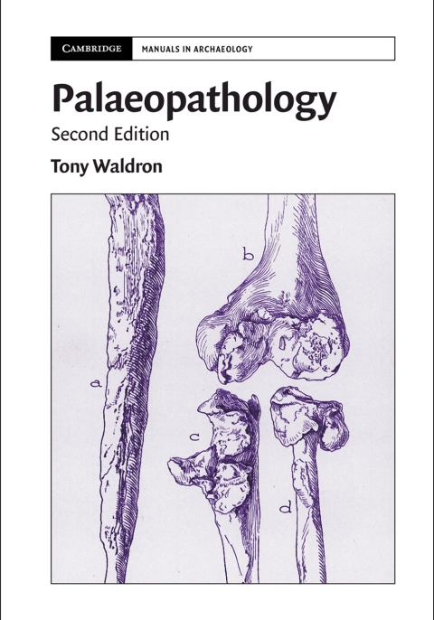 Cover image for book Palaeopathology