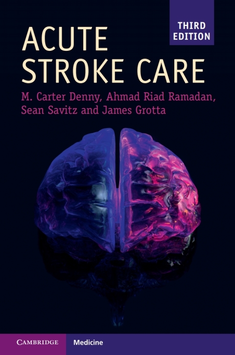 Acute Stroke Care 