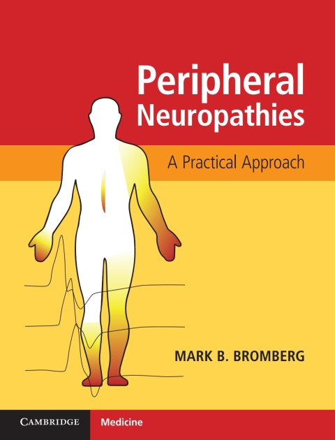 Cover image for book Peripheral Neuropathies