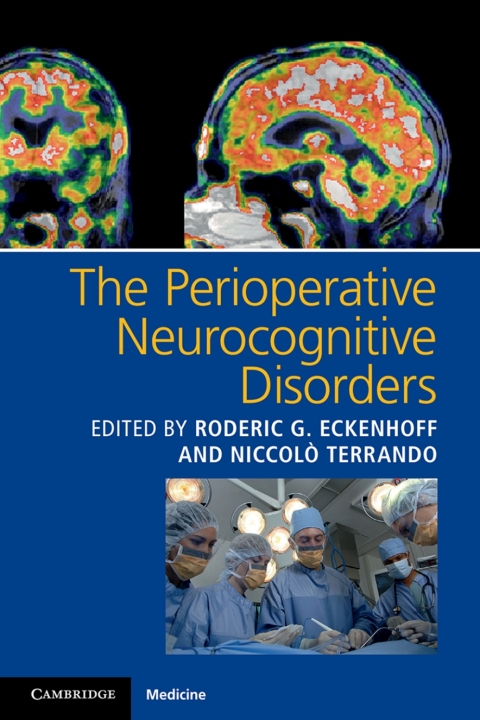 Cover image for book The Perioperative Neurocognitive Disorders