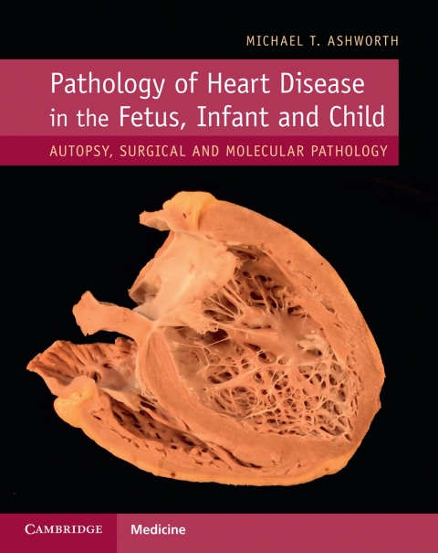 Cover image for book Pathology of Heart Disease in the Fetus, Infant and Child