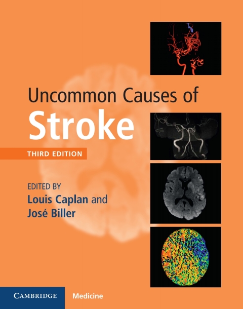 Uncommon Causes of Stroke 