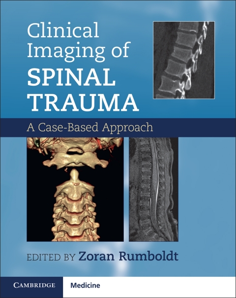 Cover image for book Clinical Imaging of Spinal Trauma