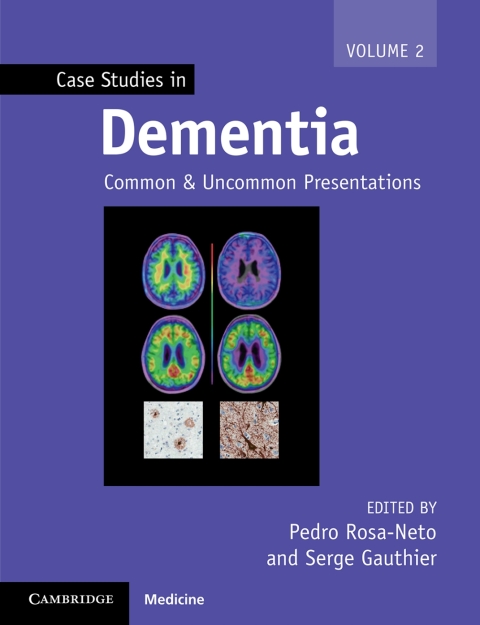 Cover image for book Case Studies in Dementia