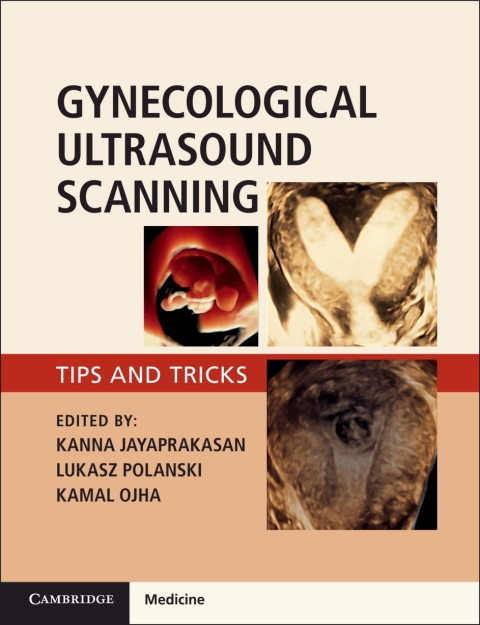 Cover image for book Gynaecological Ultrasound Scanning