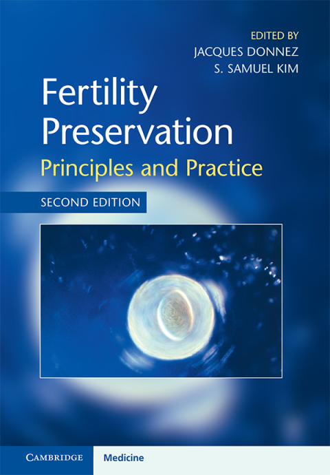 Cover image for book Fertility Preservation