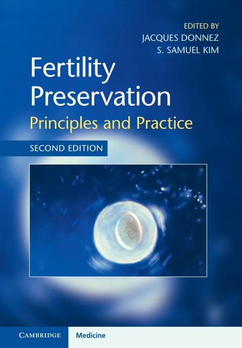 Cover image for book Fertility Preservation