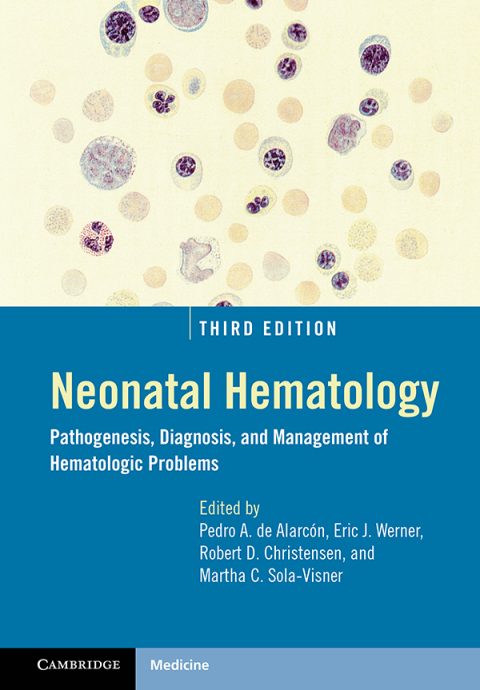 Cover image for book Neonatal Hematology