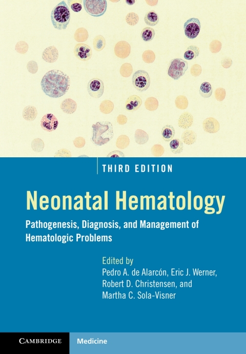 Cover image for book Neonatal Hematology