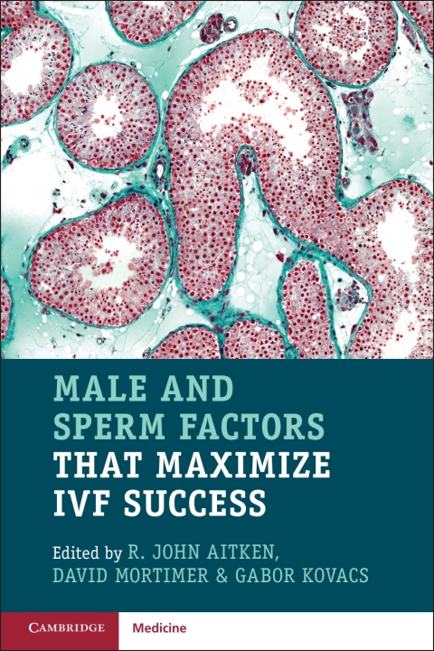 Cover image for book Male and Sperm Factors that Maximize IVF Success