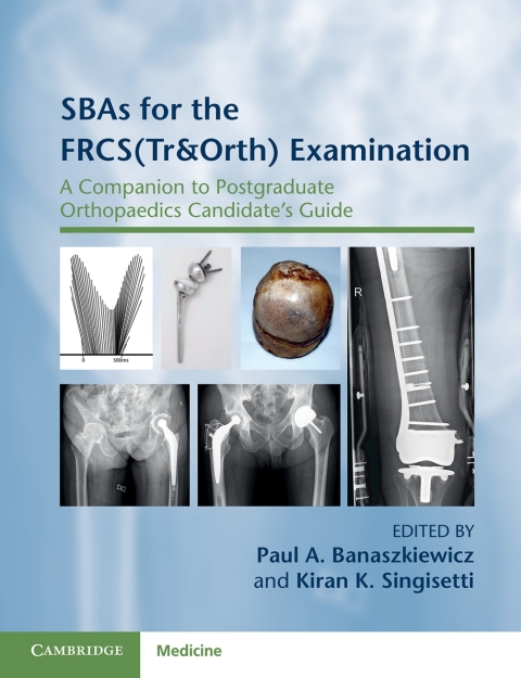 SBAs for the FRCS(Tr\u0026Orth) Examination 