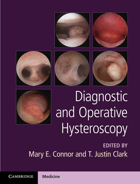 Cover image for book Diagnostic and Operative Hysteroscopy