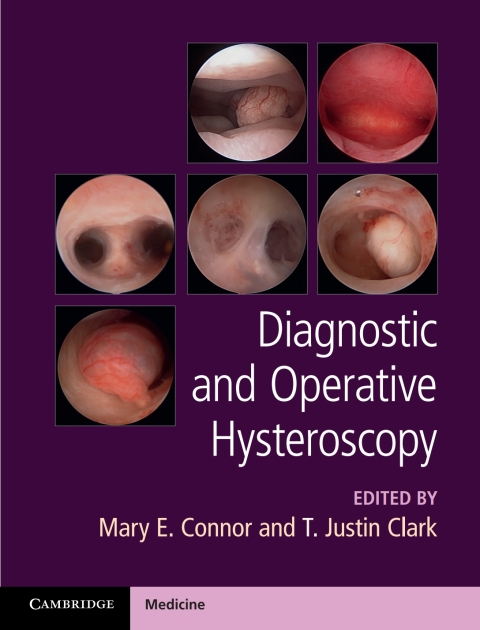 Cover image for book Diagnostic and Operative Hysteroscopy