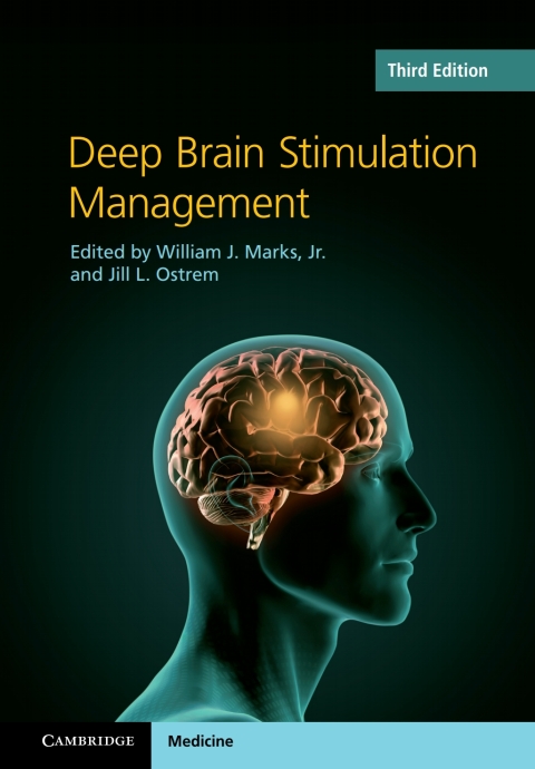 Cover image for book Deep Brain Stimulation Management