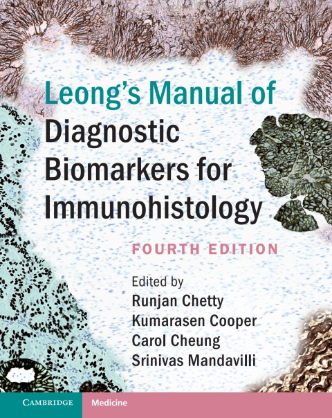 Cover image for book Leong's Manual of Diagnostic Biomarkers for Immunohistology