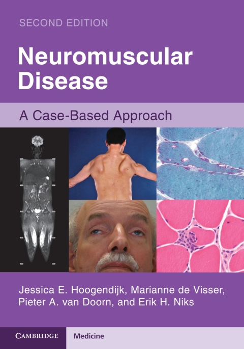 Cover image for book Neuromuscular Disease