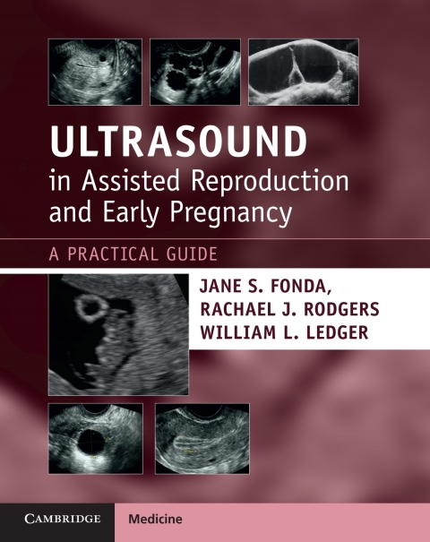 Ultrasound in Assisted Reproduction and Early Pregnancy 