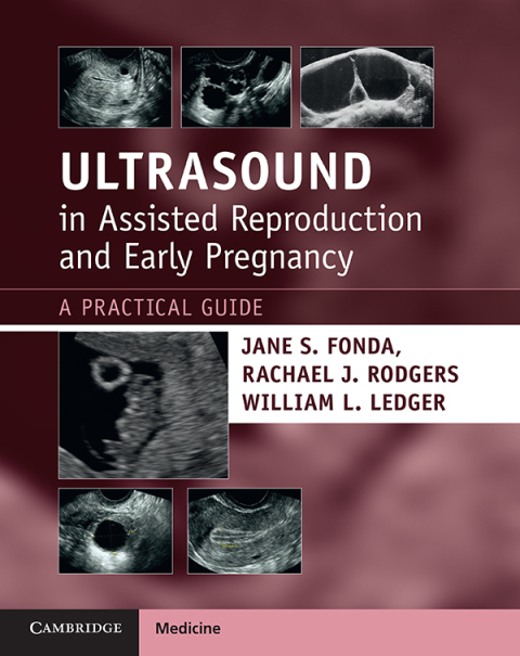 Ultrasound in Assisted Reproduction and Early Pregnancy 
