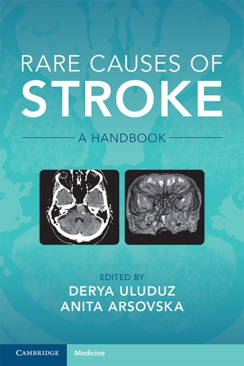 Cover image for book Rare Causes of Stroke