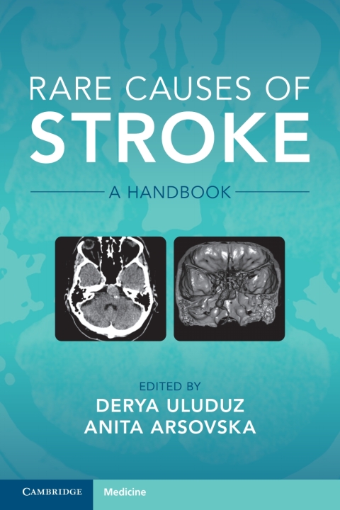Cover image for book Rare Causes of Stroke