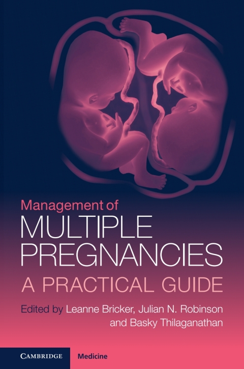 Cover image for book Management of Multiple Pregnancies