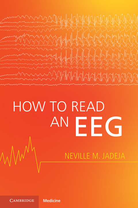 Cover image for book How to Read an EEG