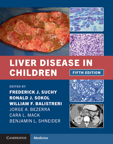 Cover image for book Liver Disease in Children