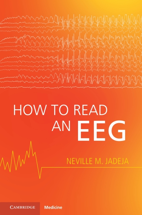 Cover image for book How to Read an EEG