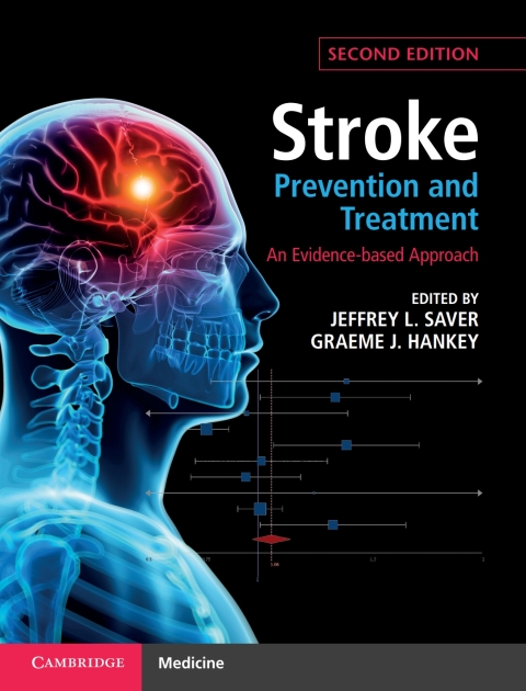 Cover image for book Stroke Prevention and Treatment