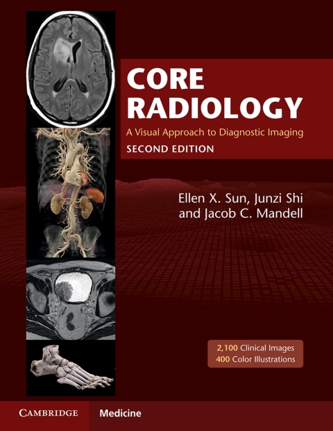 Cover image for book Core Radiology