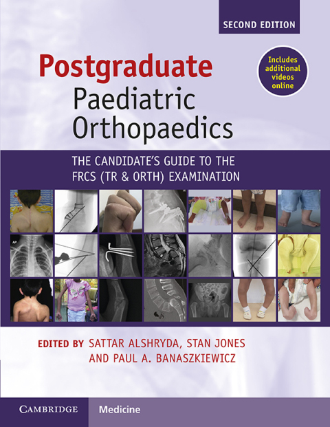 Postgraduate Paediatric Orthopaedics 