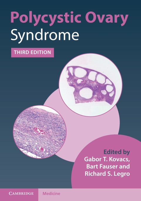 Cover image for book Polycystic Ovary Syndrome