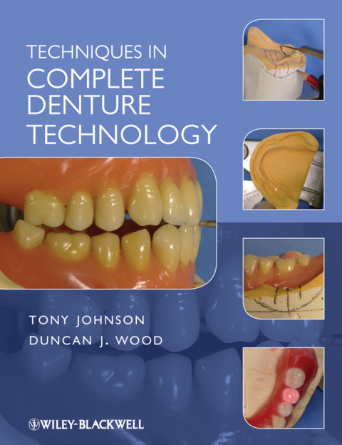 Techniques in Complete Denture Technology 