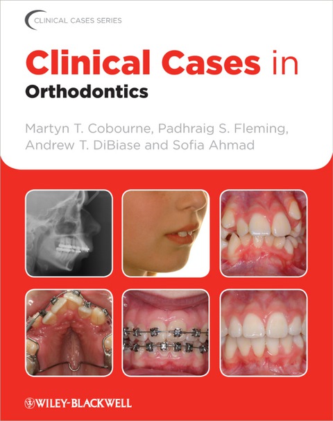 Clinical Cases in Orthodontics 