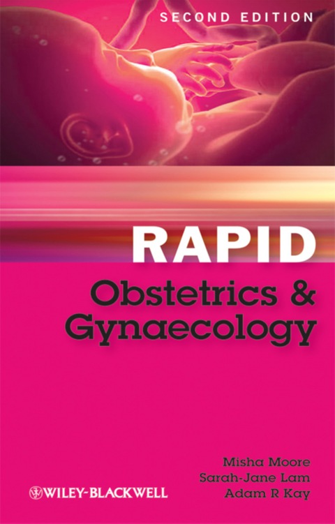 Rapid Obstetrics and Gynaecology 