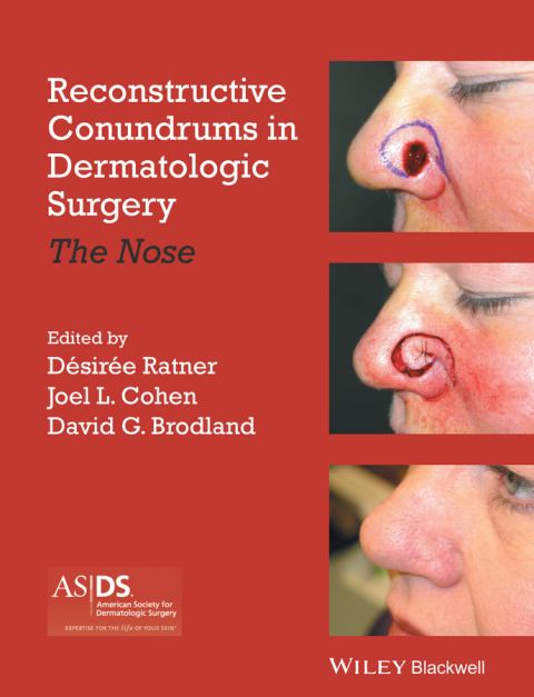 Cover image for book Reconstructive Conundrums in Dermatologic Surgery