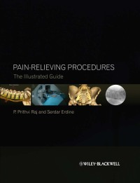 صورة الغلاف: Pain-Relieving Procedures: The Illustrated Guide 1st edition 9780470670385
