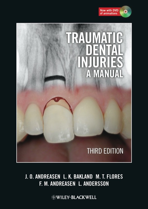 Cover image for book Traumatic Dental Injuries: A Manual