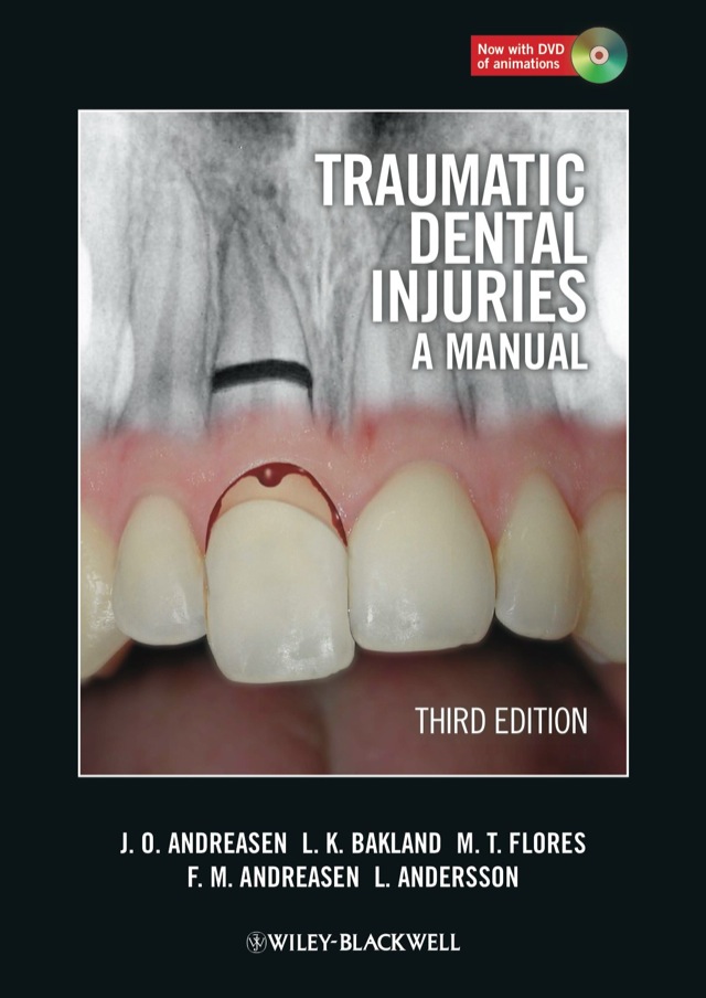 Traumatic Dental Injuries a Manual