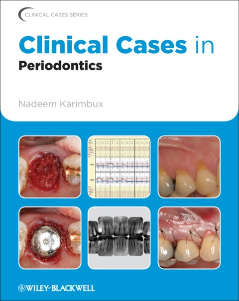 Cover image for book Clinical Cases in Periodontics