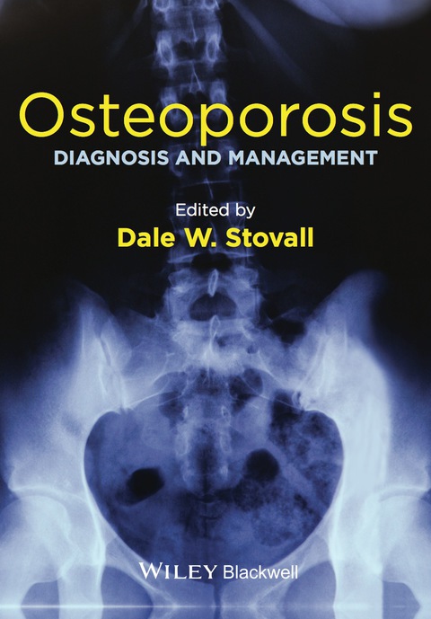 Cover image for book Osteoporosis: Diagnosis and Management