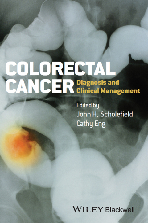Cover image for book Colorectal Cancer