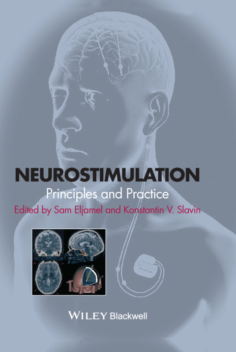 Cover image for book Neurostimulation: Principles and Practice