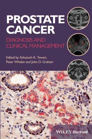 Prostate Cancer